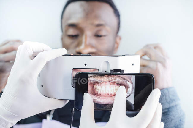 Стоматолог фотографує зуби спеціальним фотоапаратом. — стокове фото