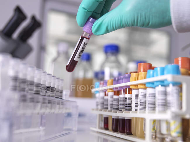Mano de científico con guante protector recogiendo muestra en laboratorio - foto de stock
