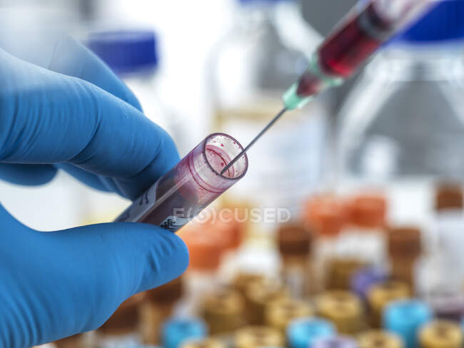 Биомедицинский техник, тестирующий образец крови в лаборатории — стоковое фото