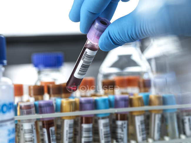 Homme scientifique tenant un flacon d'échantillon de sang en laboratoire — Photo de stock