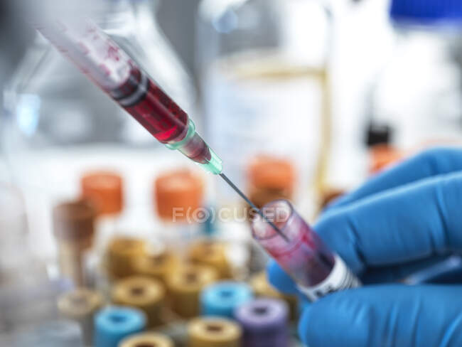 Биомедицинский ученый, работающий с образцом крови в лаборатории — стоковое фото