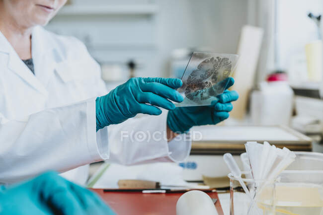 Un scientifique prépare une lame de microscope cérébral en laboratoire — Photo de stock