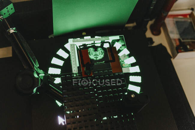 Deslizamiento cerebral humano en microscopio iluminado en laboratorio - foto de stock