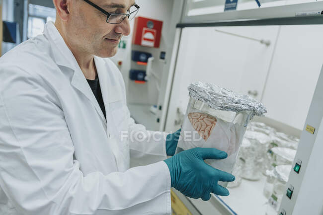 Wissenschaftler untersucht im Labor konservierten menschlichen Gehirnbecher — Stockfoto