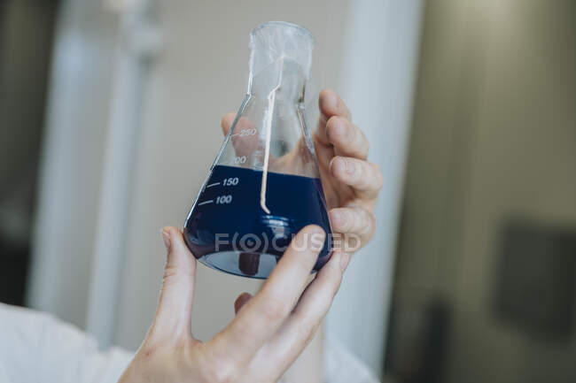 Mujer sosteniendo la mano solución líquida azul en la clínica - foto de stock