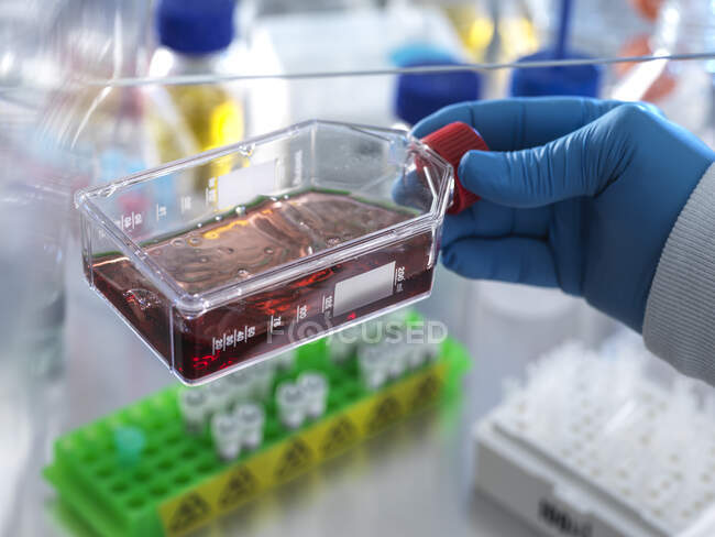 Técnico sosteniendo frasco que contiene células sanguíneas mientras hace experimento en laboratorio - foto de stock