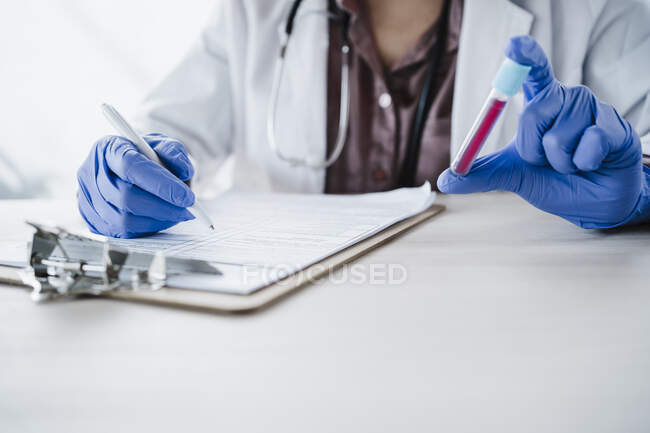 Женщина-врач держит образец крови во время написания медицинского заключения за столом — стоковое фото
