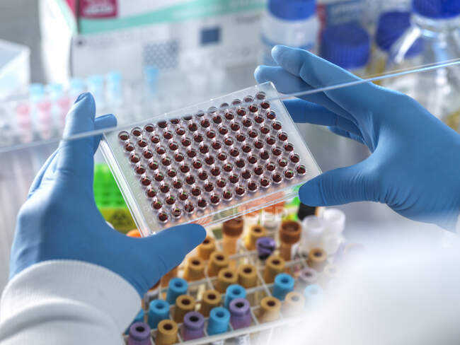 Cientista masculino segurando amostras de sangue em placa de poço múltiplo em laboratório — Fotografia de Stock