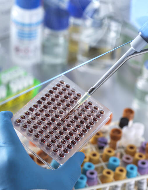 Científico masculino pipeteando muestra de sangre en microplaca en laboratorio - foto de stock