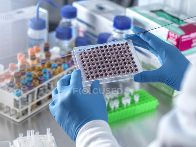 Científico sosteniendo muestras de sangre en placa de pozo múltiple en el laboratorio - foto de stock