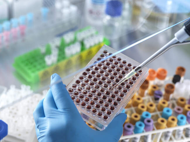 Científico pipeteando muestra de sangre en microplaca en laboratorio - foto de stock