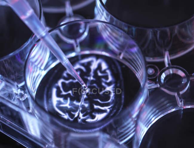 Медичний зразок усередині мікроплити з зображенням людського мозку. — стокове фото