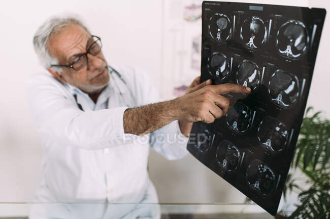 Senior medico di sesso maschile che spiega i raggi X in ospedale — Foto stock