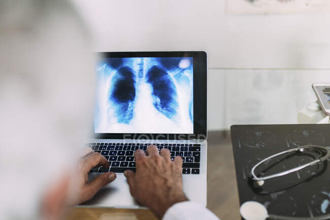 Medico maschio che utilizza il computer portatile mentre si lavora a raggi X in clinica — Foto stock