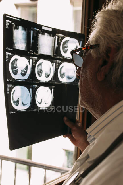 Старший чоловік, який працює санітаром, оглядає рентген перед вікном у клініці. — стокове фото