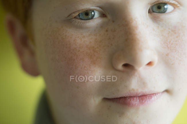 Портрет мальчика с веснушками крупным планом — стоковое фото