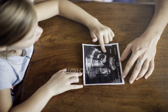 Menina olhando para ultra-som foto de seu novo irmão para ser — Fotografia de Stock