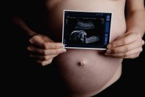 Mittelteil der Schwangeren mit Ultraschall vor dem Bauch — Stockfoto