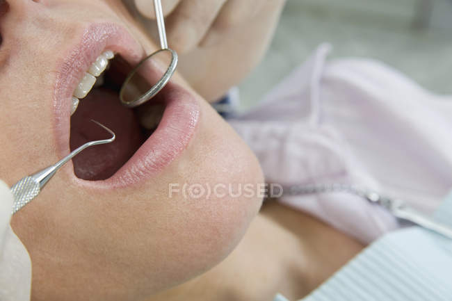Crop dentist's hands inspecting woman's mouth — Stock Photo