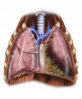 Depiction of mesothelioma in lungs — Stock Photo