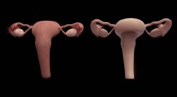 Representación 3D del sistema reproductor femenino sobre fondo negro - foto de stock