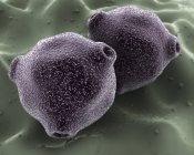 Vue microscopique du pollen de bouleau sur fond vert — Photo de stock
