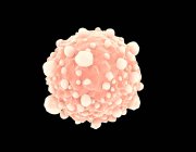 Vista microscópica de las células cancerosas de páncreas - foto de stock