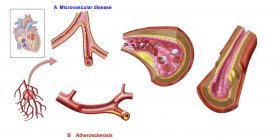 Ilustración médica de la anatomía de los vasos sanguíneos - foto de stock