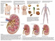 Ärztliches Diagramm mit den Anzeichen und Symptomen von Nierensteinen — Stockfoto