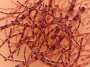 Microscopic view of Bacillus anthracis bacteriophyta — Stock Photo