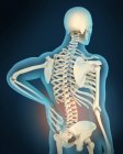 Illustration médicale de l'inflammation et de la douleur dans le dos humain — Photo de stock