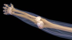 Menschlicher Arm mit Ellenbogengelenk und Knochen röntgen auf schwarzem Hintergrund — Stockfoto