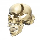 Перспективний погляд на людський череп з частинами вибухнув — стокове фото