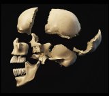 Vista lateral del cráneo humano con partes explotadas - foto de stock