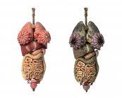 Representación 3D comparando órganos femeninos sanos y poco saludables - foto de stock
