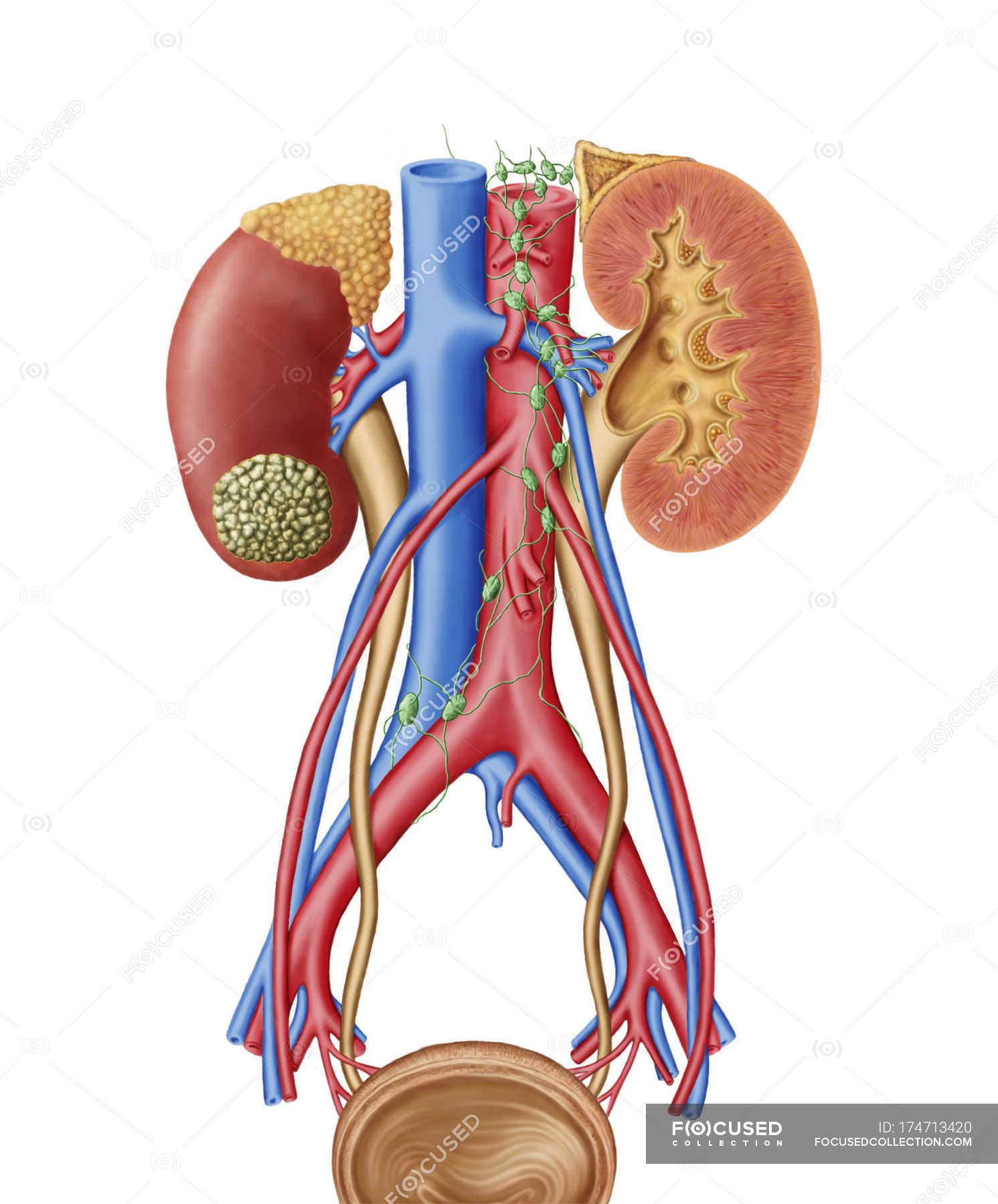 early-stage-of-kidney-cancer-with-a-tumor-on-the-kidney-abdominal