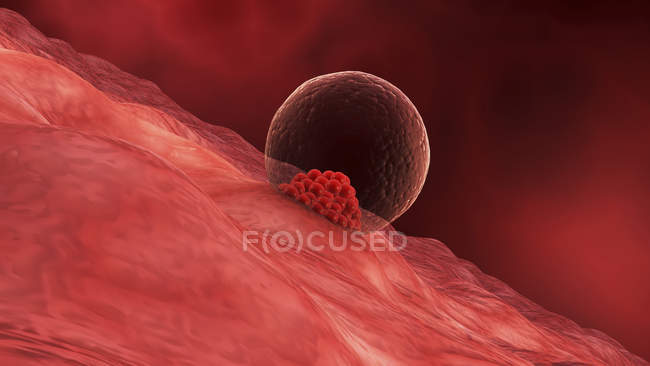 Ilustración médica del blastocisto que comienza a implantarse en la pared del útero - foto de stock