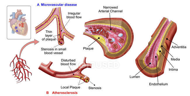 Illustrazione medica dell'anatomia dei vasi sanguigni con etichette — Foto stock