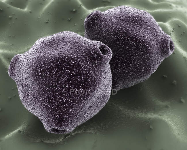Vue microscopique du pollen de bouleau sur fond vert — Photo de stock