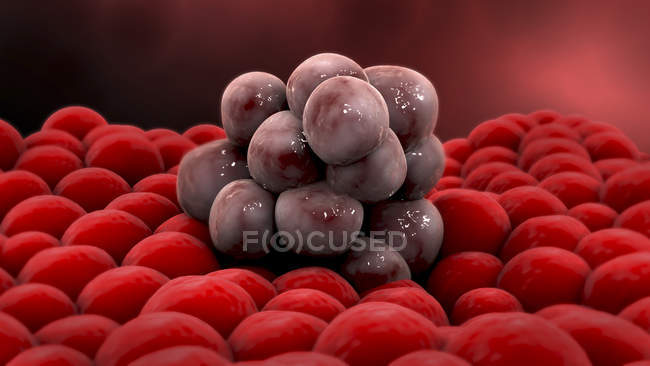 Мікроскопічні видом на барвисті пухлинних клітин — стокове фото