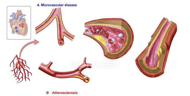 Медицинская иллюстрация анатомии кровеносных сосудов — стоковое фото