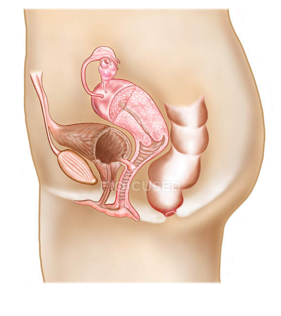Cross section of female vesicovaginal fistula — Stock Photo