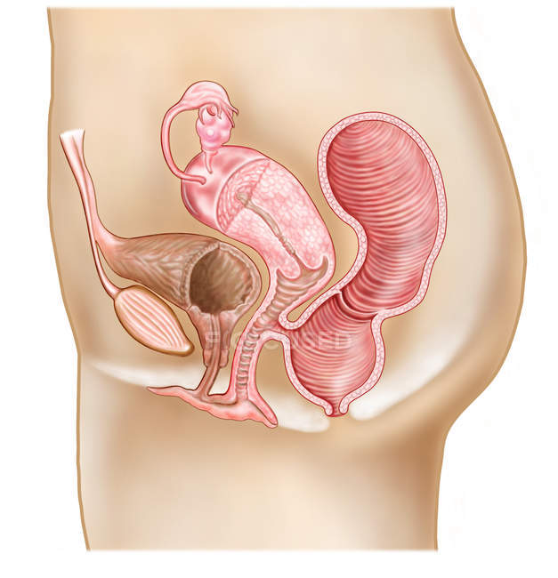Fístula rectovaginal y sección transversal de órganos reproductores femeninos con sección transversal del recto - foto de stock