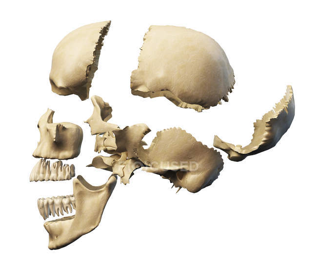 Vue latérale du crâne humain avec des pièces explosées — Photo de stock