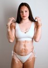 Junge Frau mit Vitiligo-Krankheit posiert im Studio in einem weißen Bikini — Stockfoto
