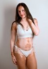 Mujer joven, con enfermedad de vitiligo, posando en el estudio en un bikini blanco - foto de stock