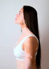 Retrato lateral de uma jovem, um verdadeiro paciente vitiligo, posando no estúdio — Fotografia de Stock