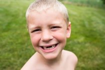 Nahaufnahme eines lächelnden zahnlosen Jungen mit Brummschädel im Hinterhof — Stockfoto