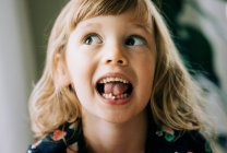 Young girl with wobbly tooth pulling faces showing her tooth — Stock Photo