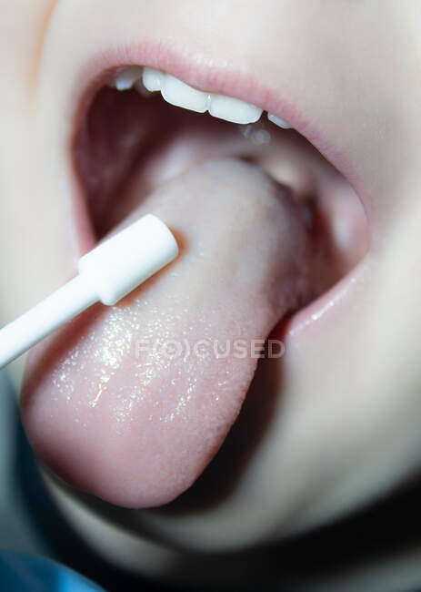 Доктор брызгает горло для больного ребенка — стоковое фото